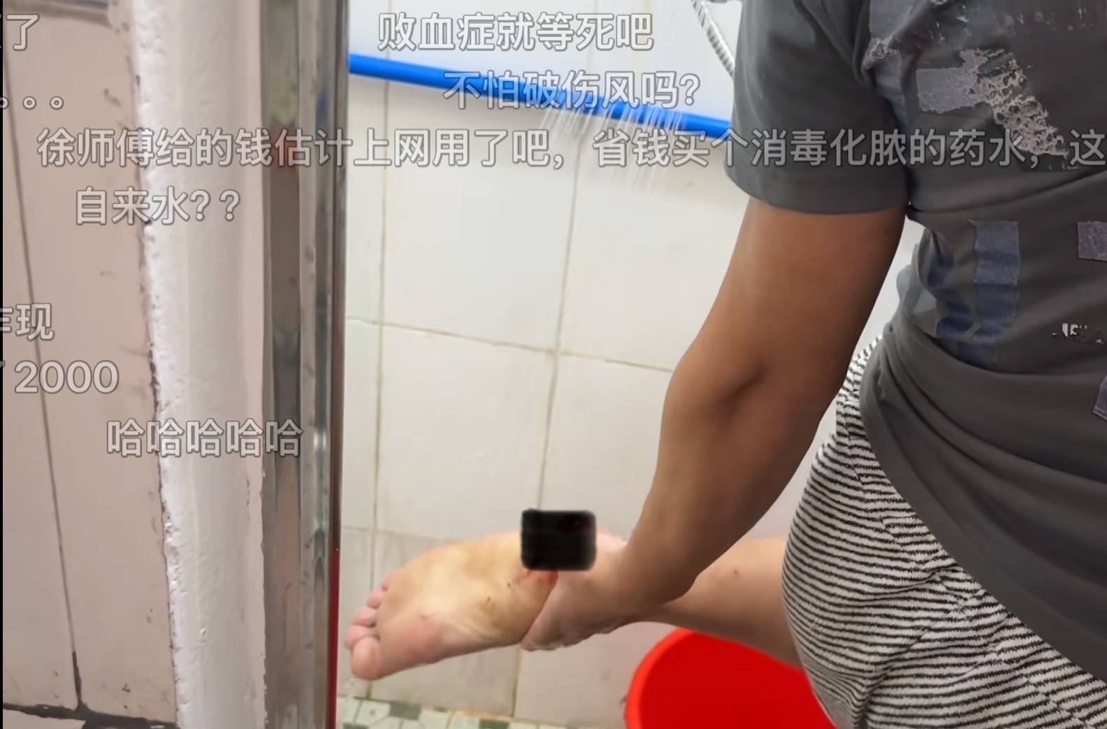 湖南一男子3年前踩钉子未就医，只用自来水洗伤口喷药，如今面临截肢风险！当事人讲述